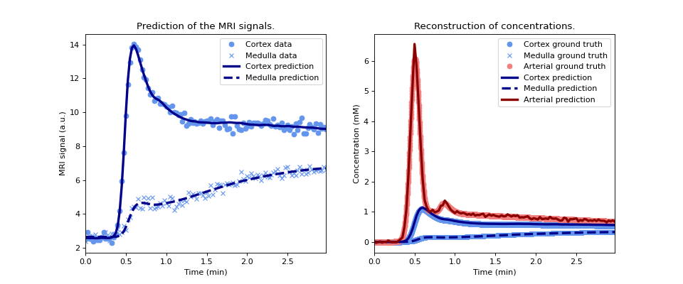 ../../_images/dcmri-KidneyCortMed-1.png