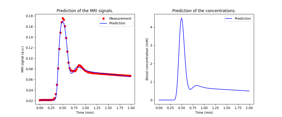 Prediction of the MRI signals., Prediction of the concentrations.