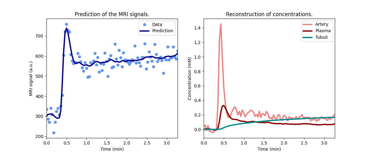 Prediction of the MRI signals., Reconstruction of concentrations.