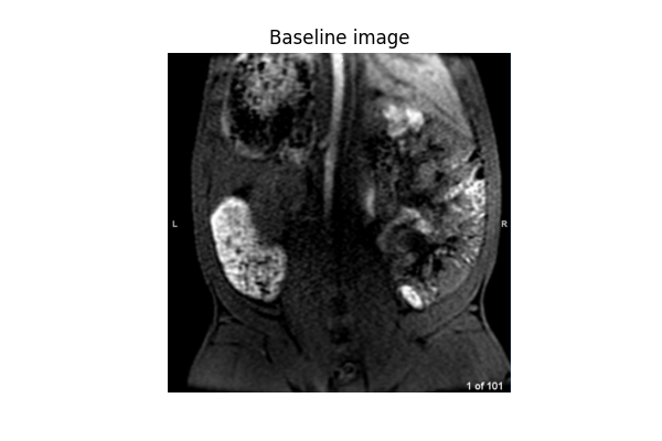 Baseline image