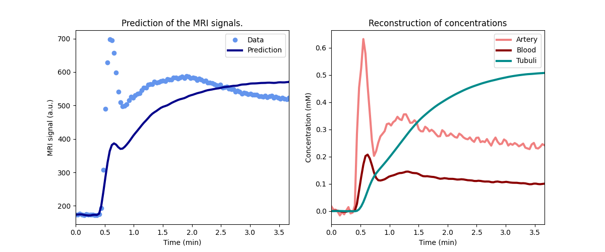 Prediction of the MRI signals., Reconstruction of concentrations