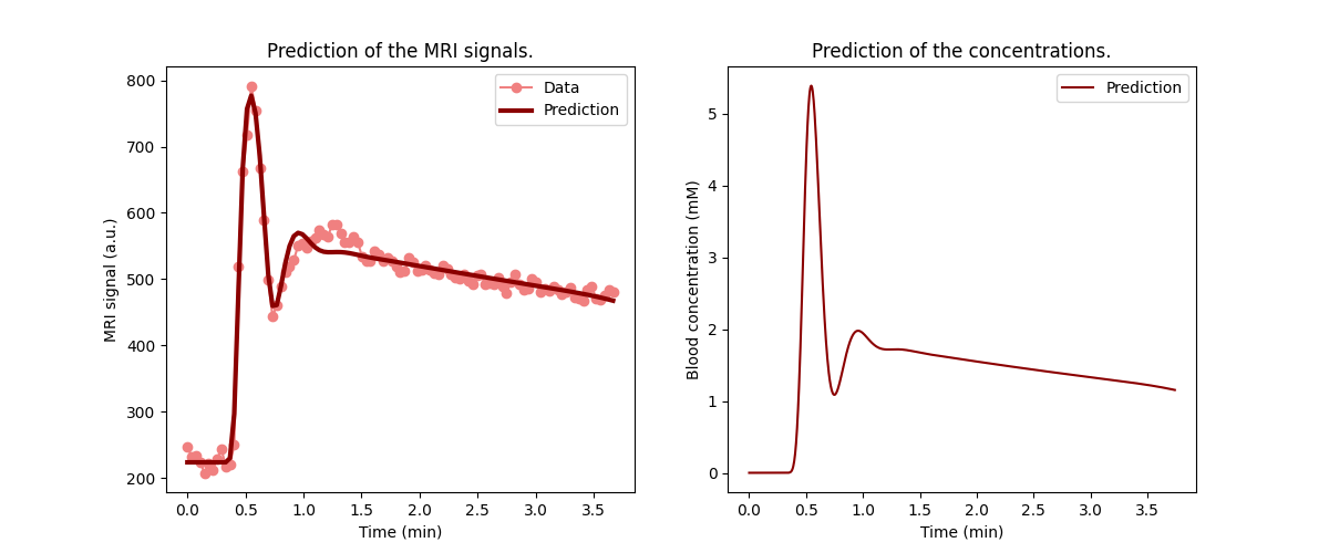 Prediction of the MRI signals., Prediction of the concentrations.