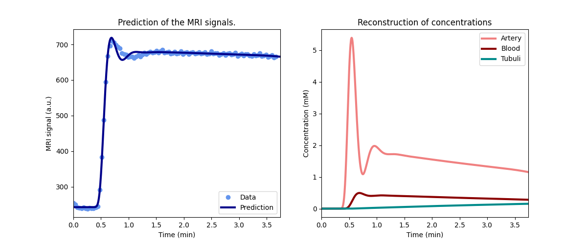 Prediction of the MRI signals., Reconstruction of concentrations